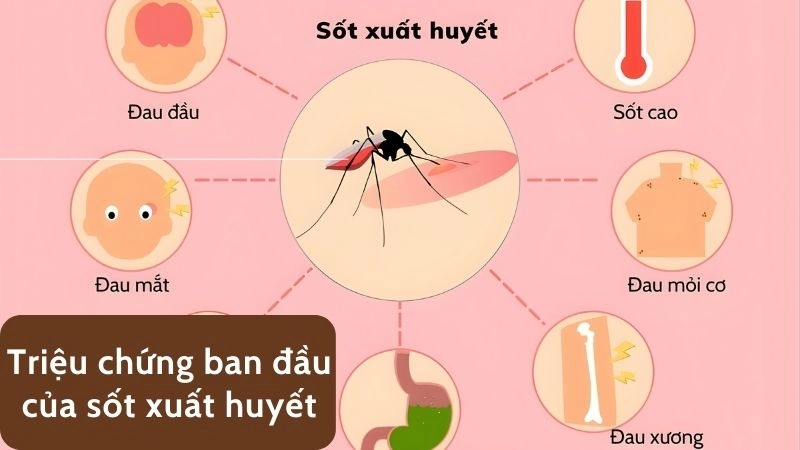 Triệu chứng ban đầu dễ bị nhầm lẫn với cảm cúm thông thường