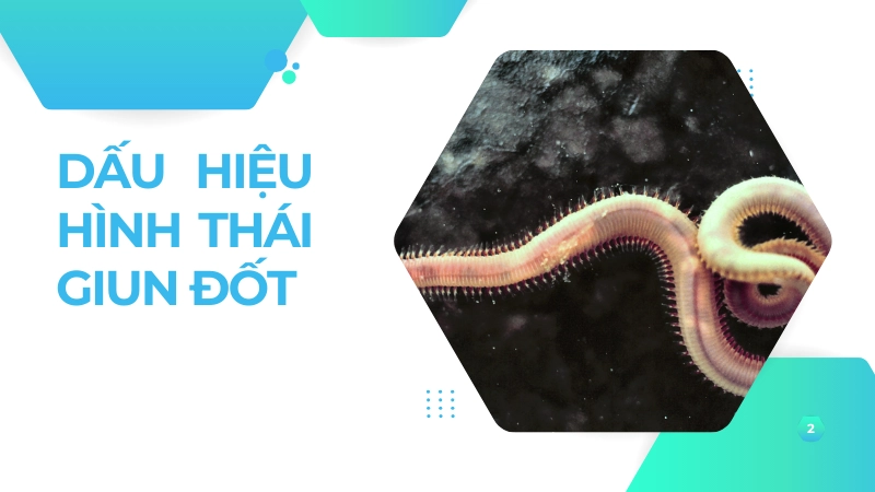 Đặc điểm hình thái giúp nhận biết giun đốt