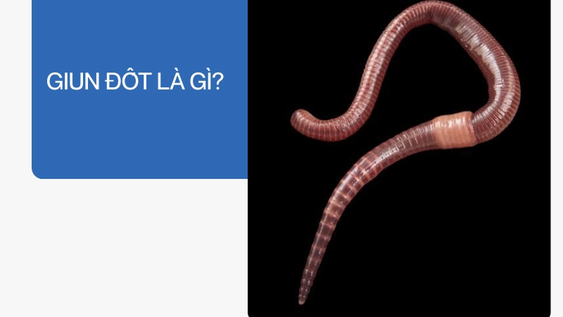 Giun đốt là gì và có ảnh hưởng đến con người không?